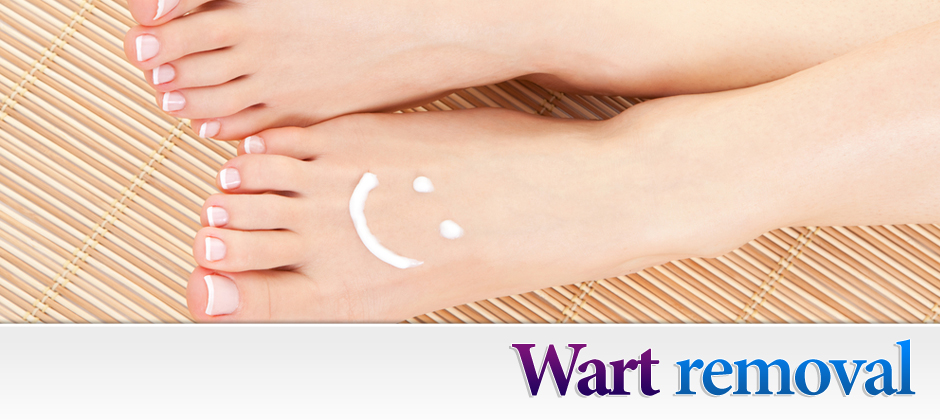 planters warts on feet. Plantar Warts can be thought