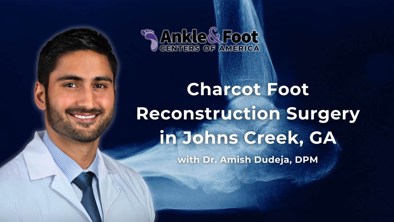 Charcot Foot Reconstruction Surgery In Johns Creek GA