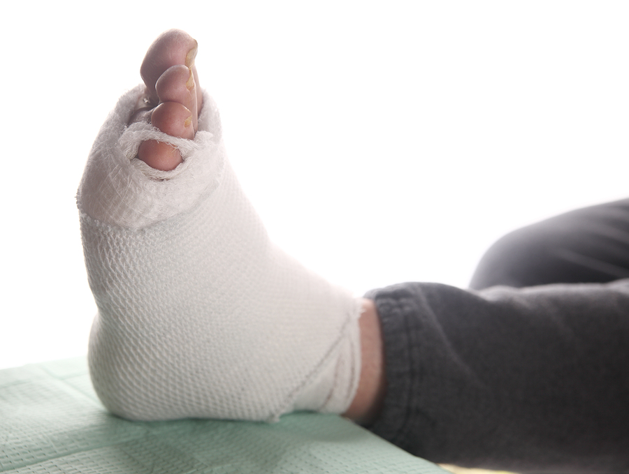 A person's foot with a bandage on it.