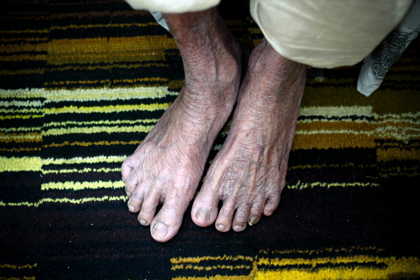 Your Golden Feet – Senior Foot Care