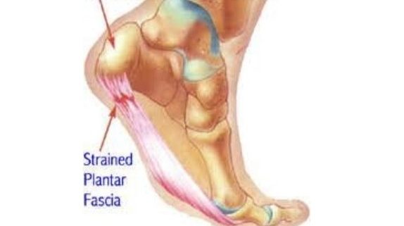 bottom of heel aches