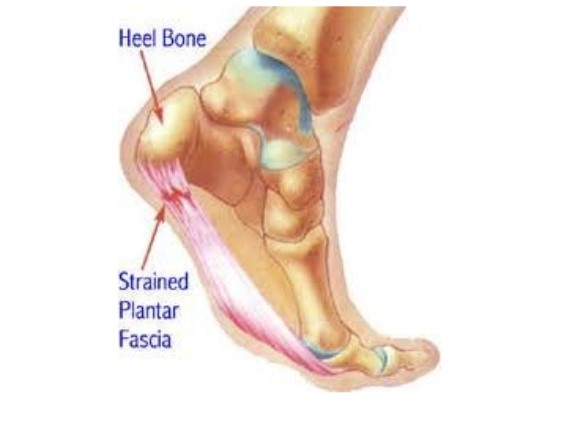 Heel Pain Relief – Ankle \u0026 Foot 