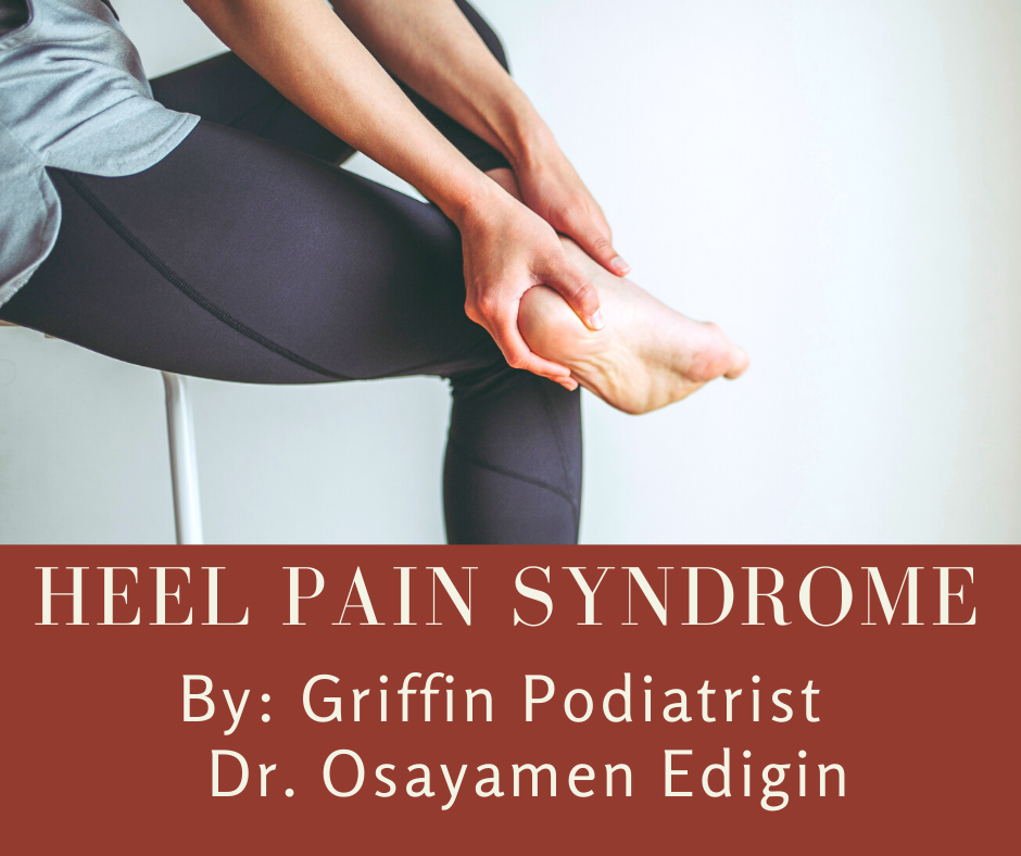 Heel Pain Syndrome by Griffin Podiatrist Dr. Osayamen Edigin