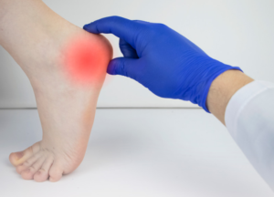 Heel Pain - What symptoms does a podiatrist treat? Our team of Marietta Podiatrists can fix a wide range of foot problems. Make an appointment with your foot doctor today!