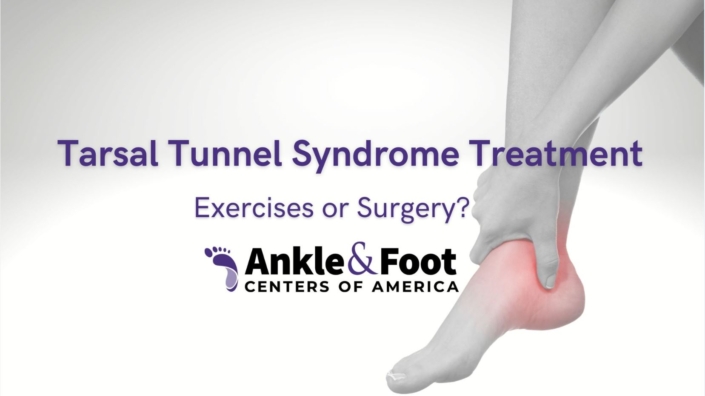 Tarsal Tunnel Syndrome Treatment Exercises Or Surgery