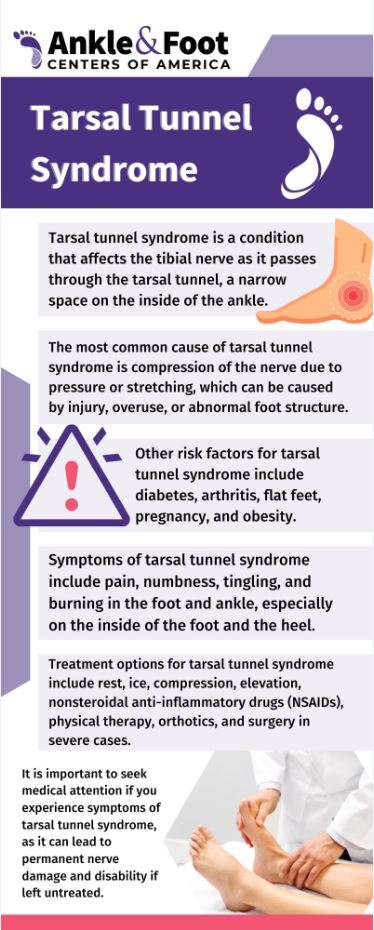 Tarsel Tunnel Syndrome