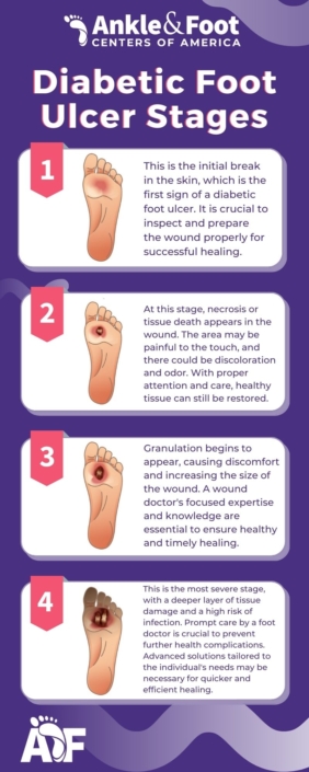 Diabetic Foot Ulcer Stages - Atlanta Wound Doctor Explains