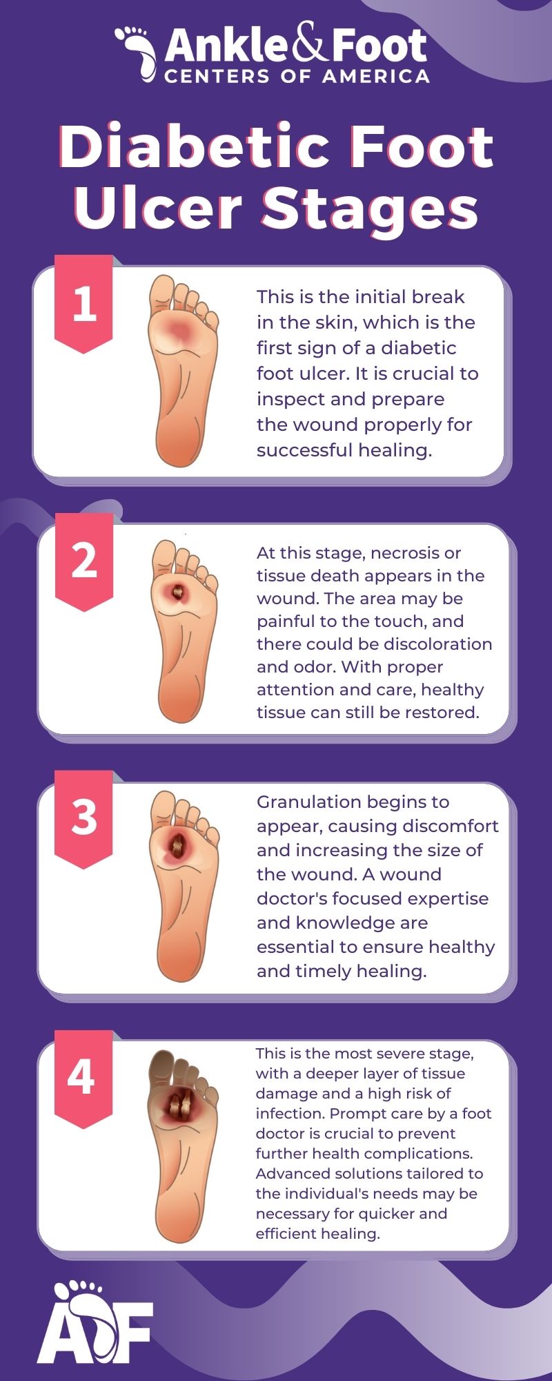 Early Stage Digital Ulcer Stages | Digital World