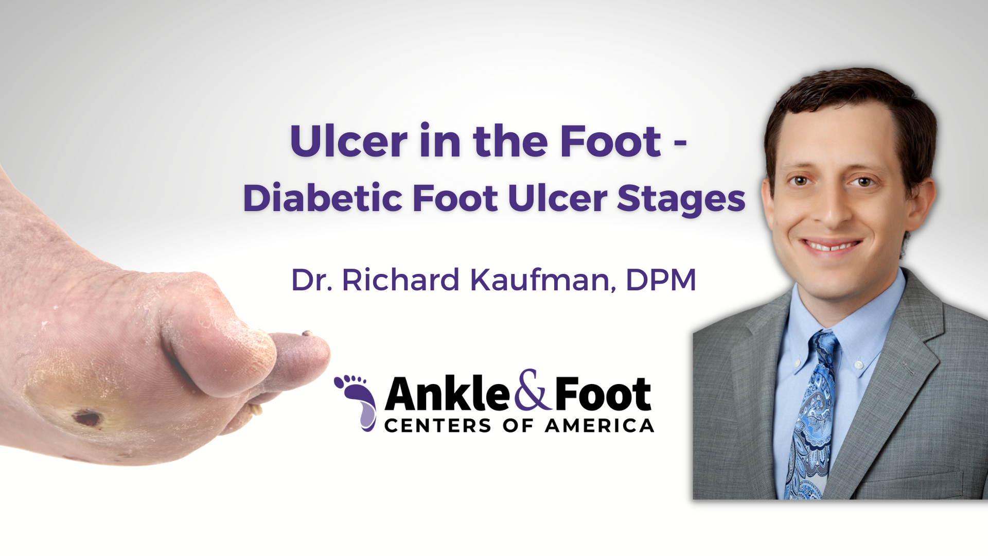 Ulcer in the Foot – Diabetic Foot Ulcer Stages