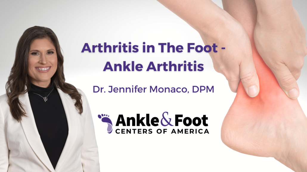 Arthritis in The Foot - Ankle Arthritis | Jenn Monaco, DPM