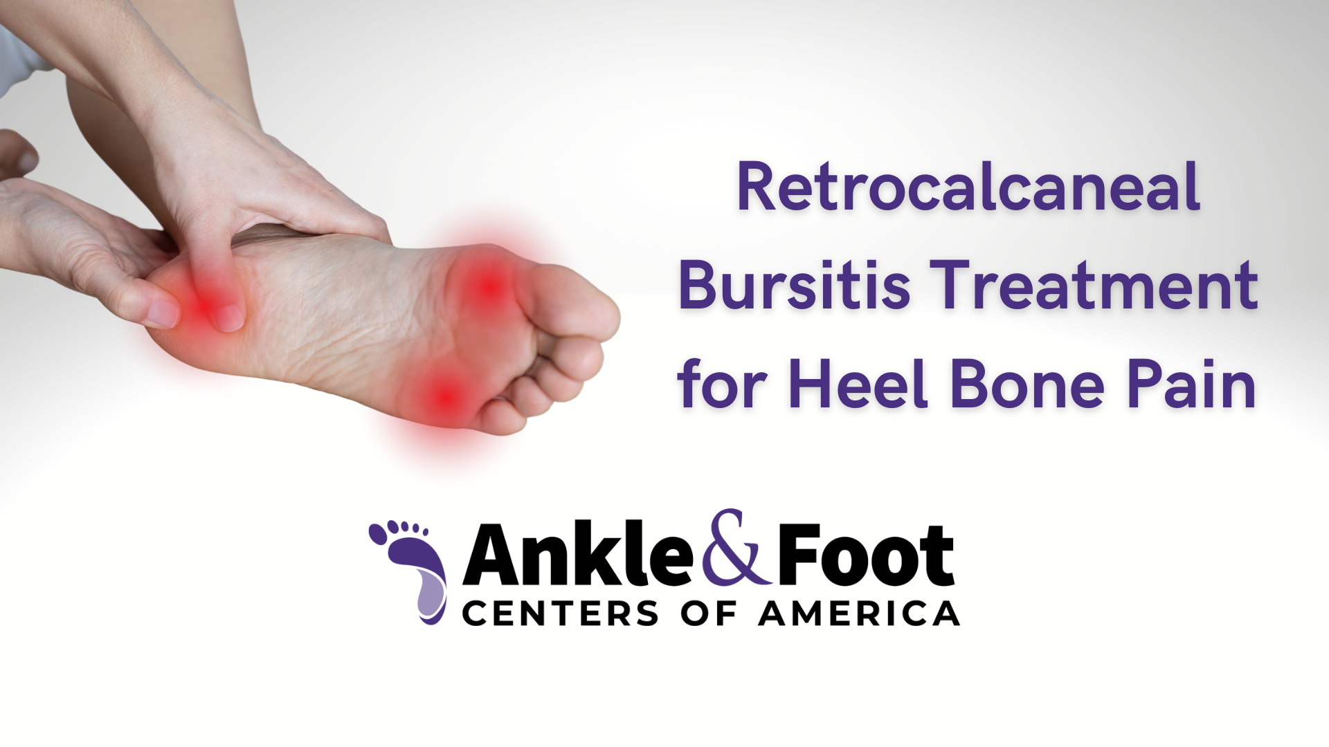 Retrocalcaneal Bursitis Treatment for Heel Bone Pain