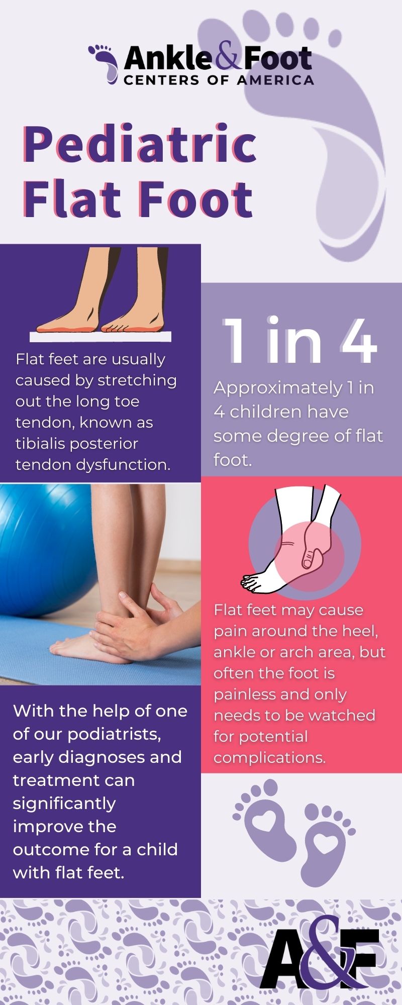 Pediatric Flatfoot - Flat Feet in Kids & Children