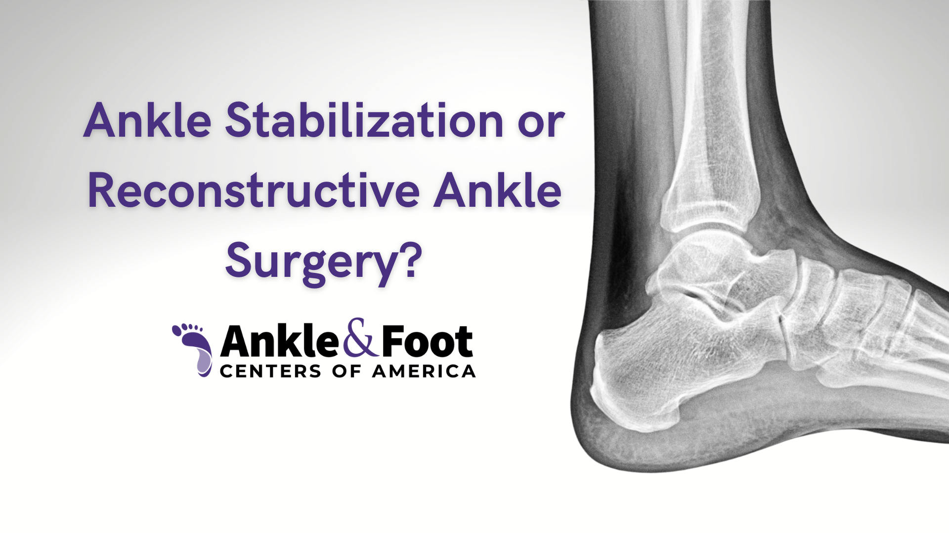 Ankle Stabilization or Reconstructive Ankle Surgery?