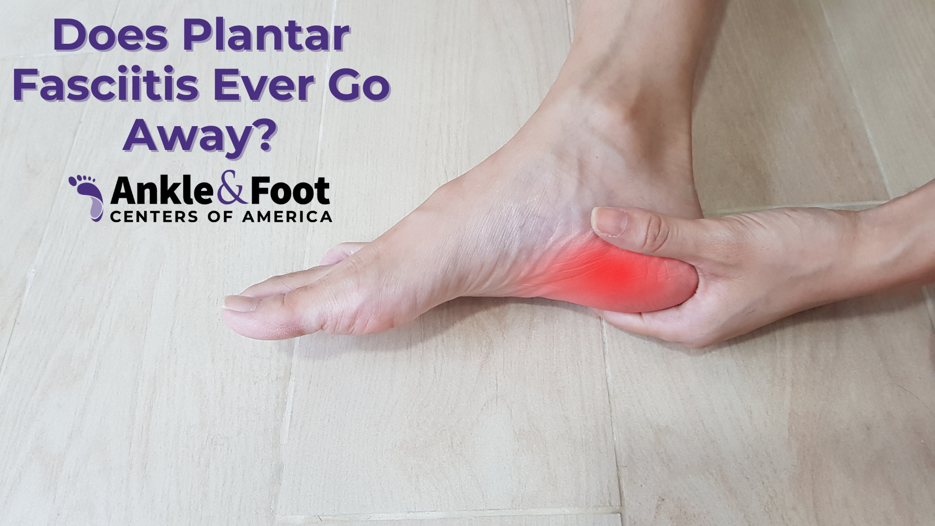Does Plantar Fasciitis Go Away? Unraveling the Mystery of Heel Pain