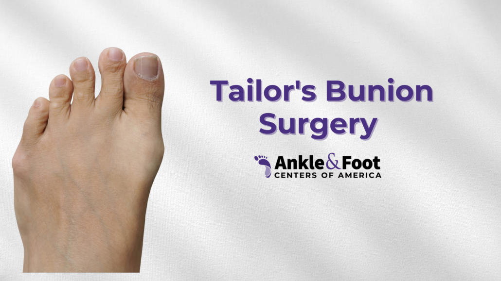 Tailor’s Bunion Surgery: Your Path To Relief