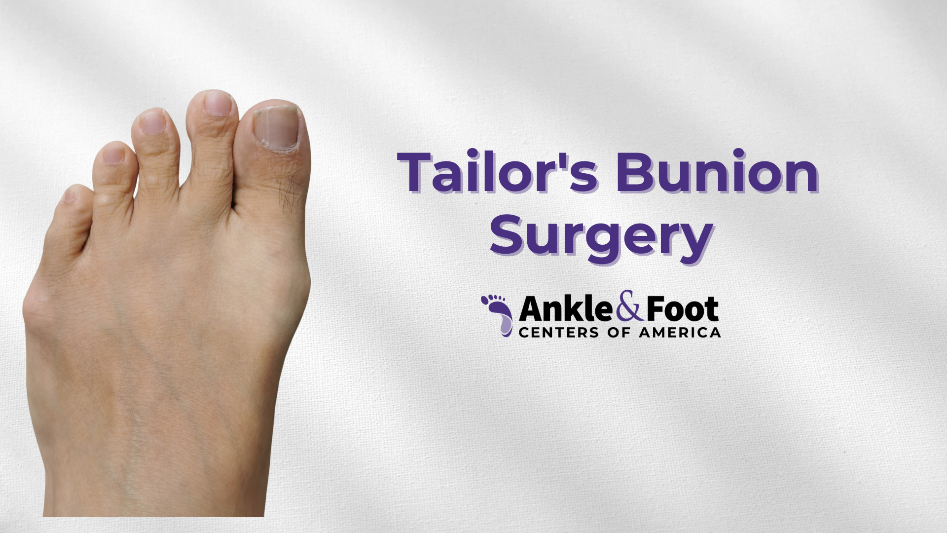 Tailor’s Bunion Surgery: Your Path to Relief