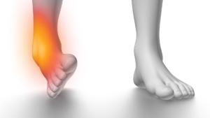 Ankle Pain From Running