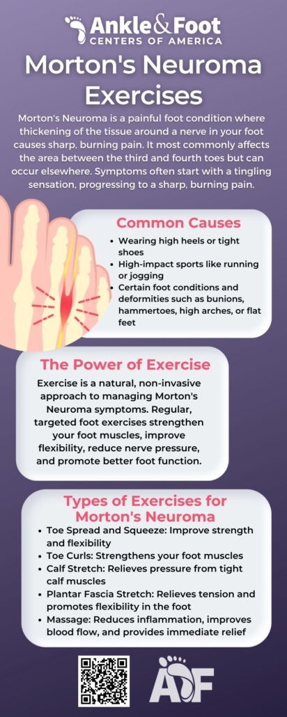Morton's Neuroma Exercises