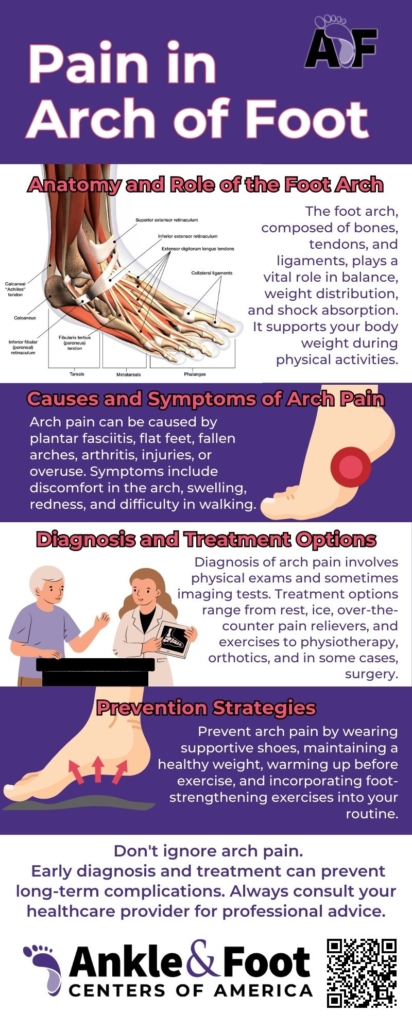 Pain in Arch of Foot Infographic