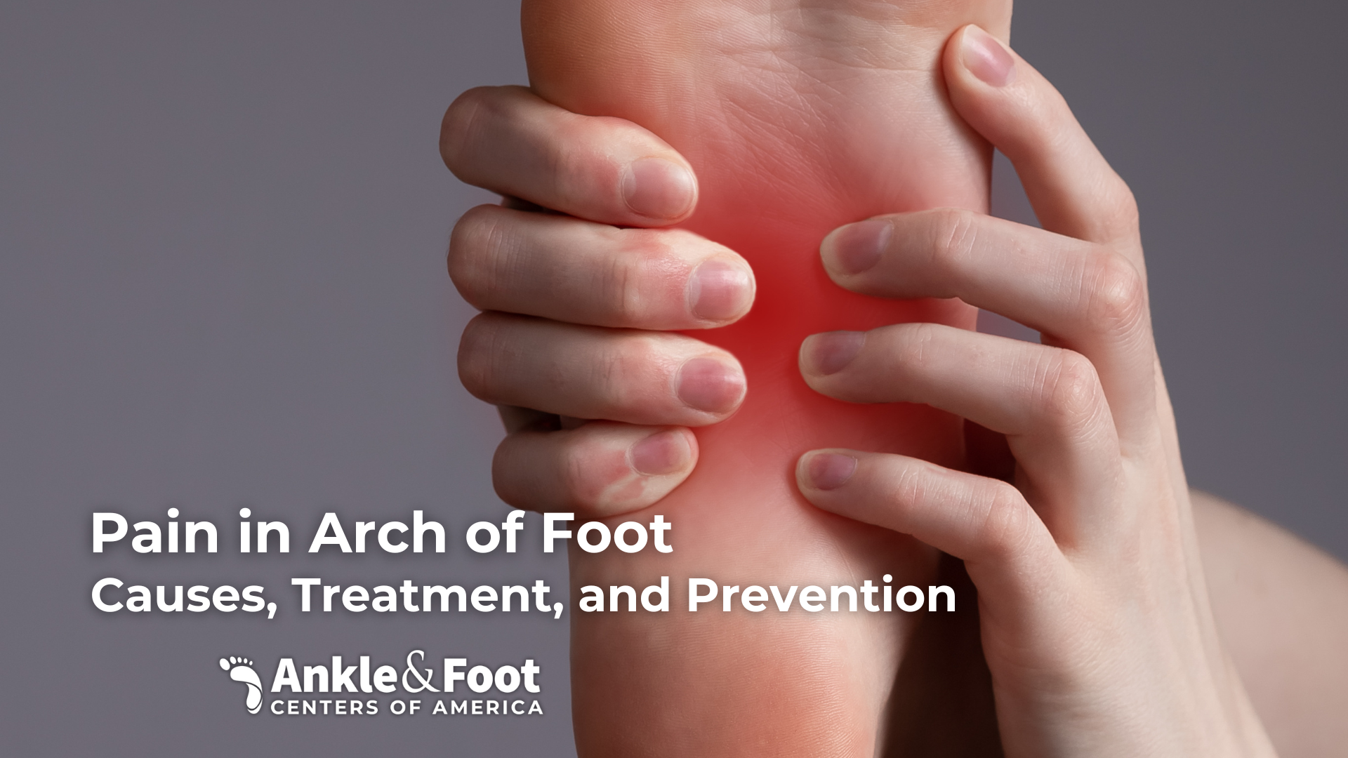 Pain in Arch of Foot