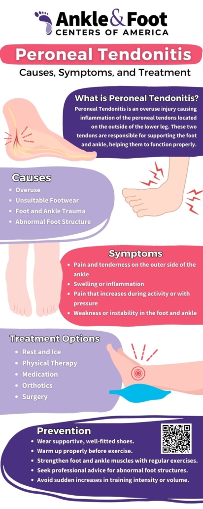 Peroneal Tendonitis Infographic