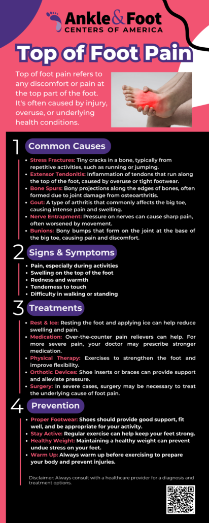 Top Of Foot Pain Infographic