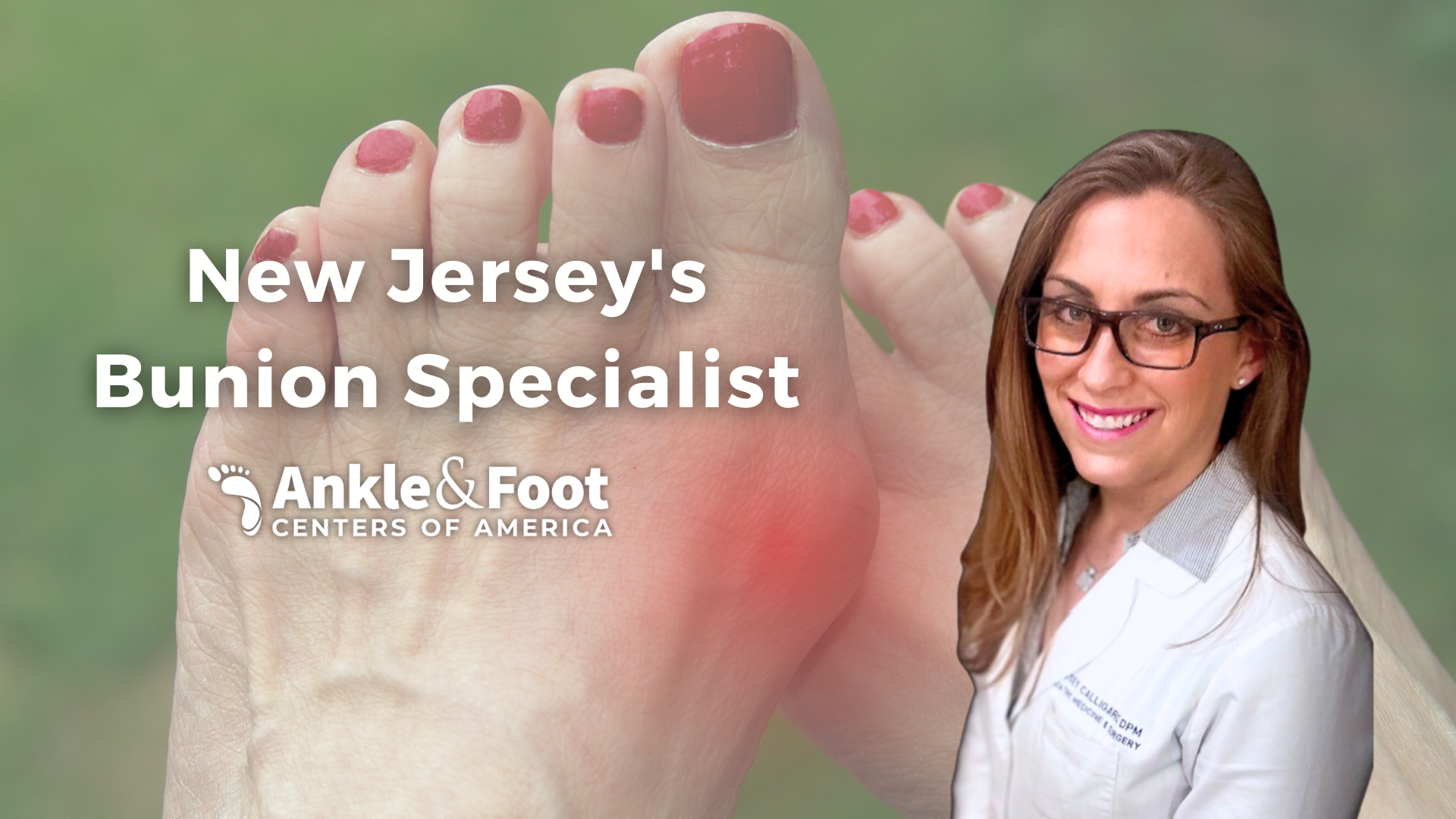 New Jersey’s Bunion Specialist | Lindsey Calligaro, DPM