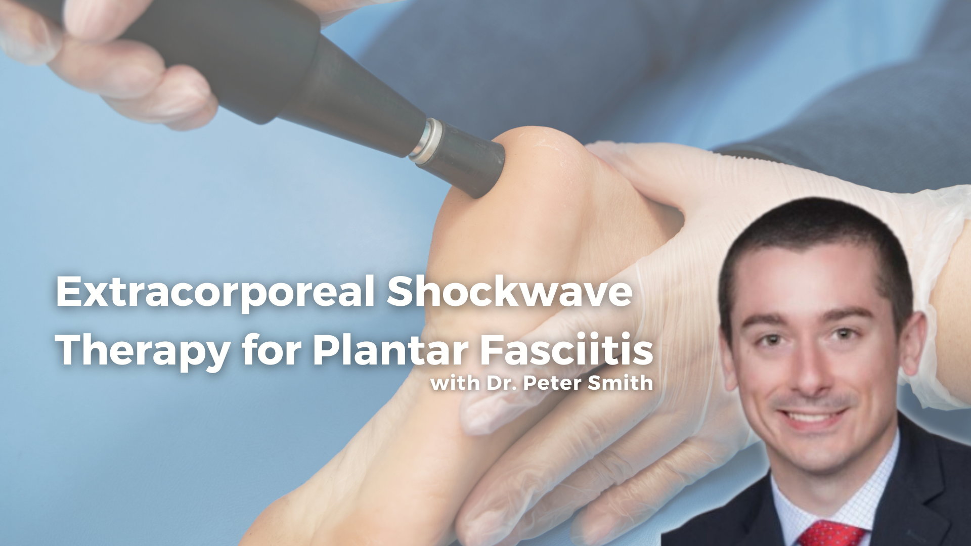 Extracorporeal Shockwave Therapy for Plantar Fasciitis
