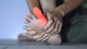 Arthritis in Big Toe