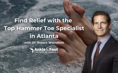 Find Relief with the Top Hammer Toe Specialist in Atlanta