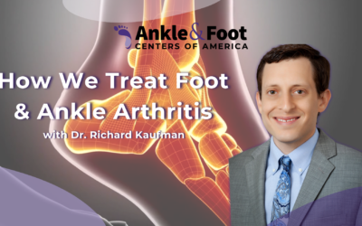 How We Treat Foot & Ankle Arthritis in Roswell, GA