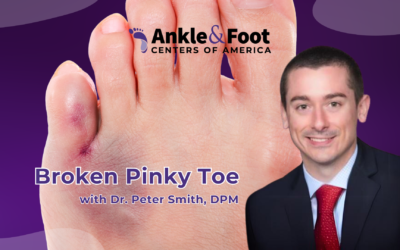 Broken Pinky Toe Fractures