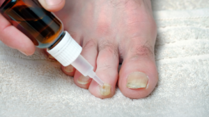 Nail Fungus Specialist in Nashville