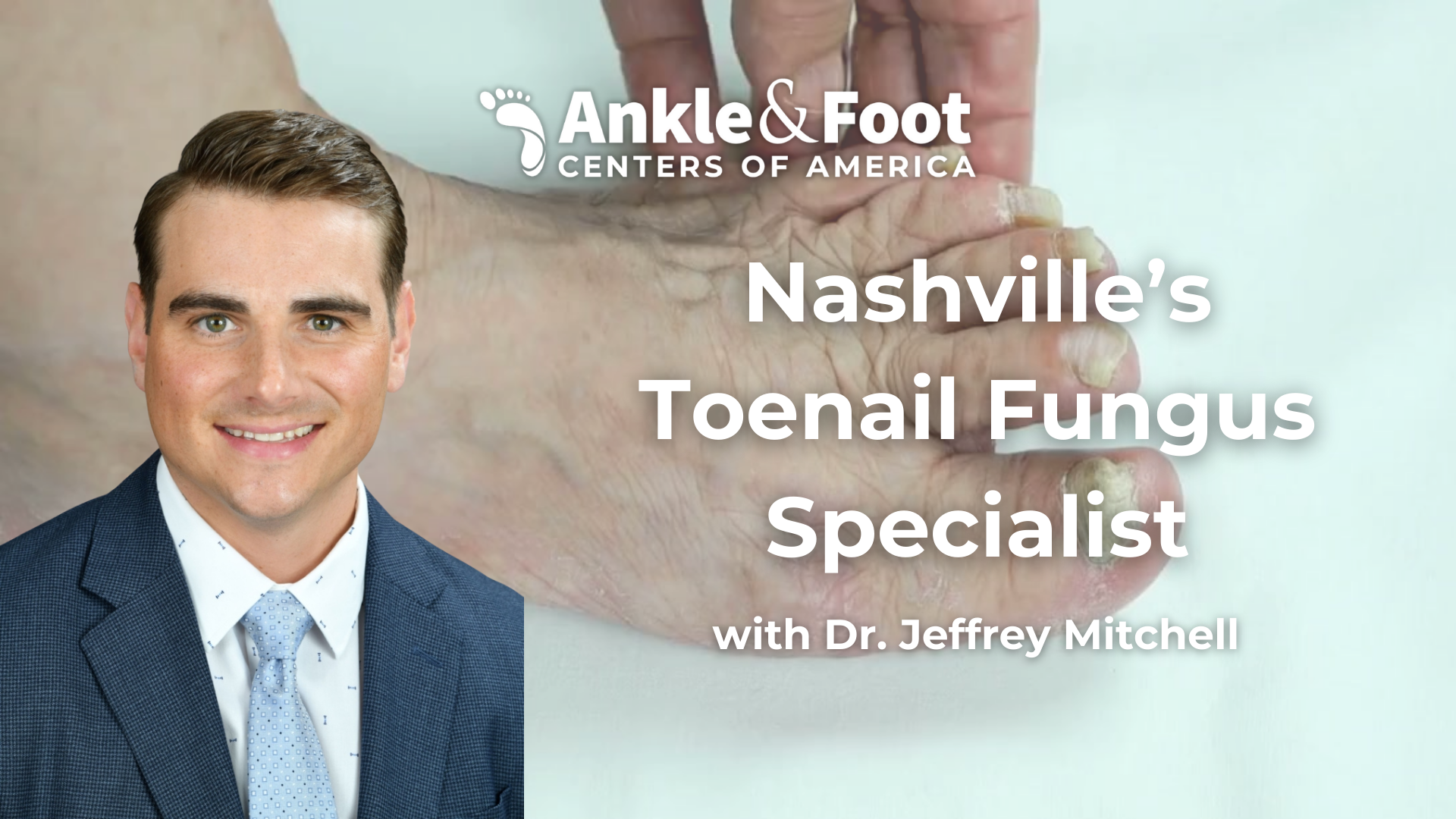 Nashville Toenail Fungus Specialist
