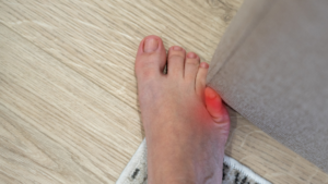Pinky Toe Fracture