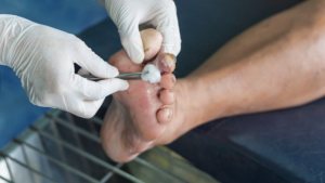 Foot Care for Diabetic Patient
