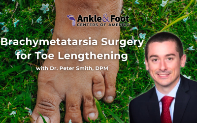 Brachymetatarsia Surgery for Toe Lengthening