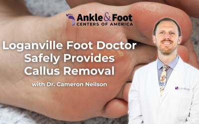 Loganville Foot Doctor Safely Provides Callus Removal