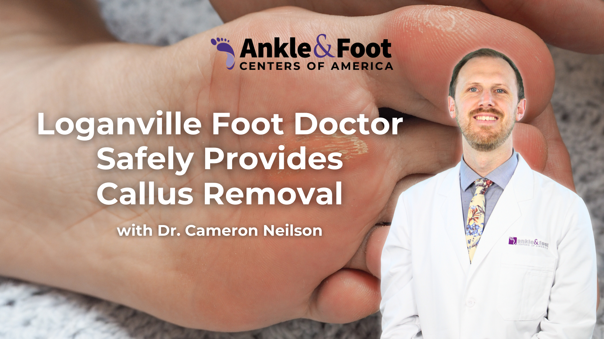 Callus Removal Loganville, GA