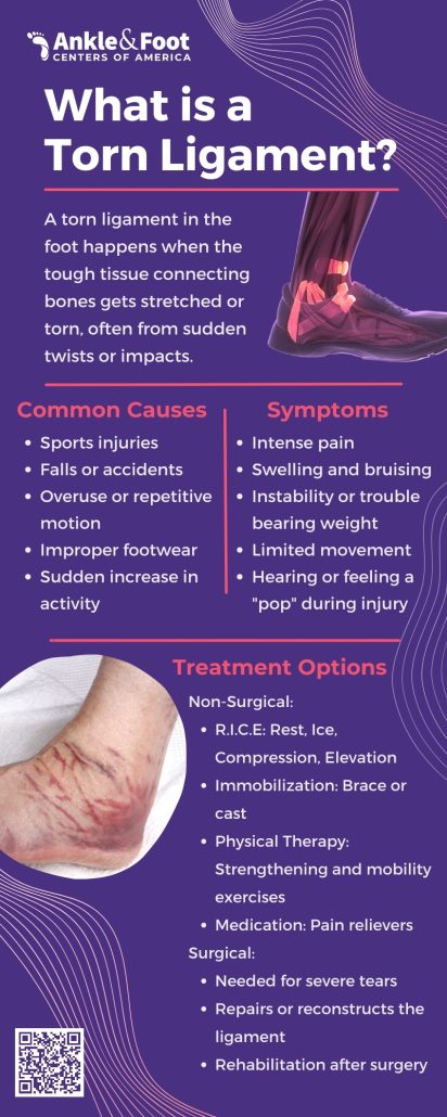 Torn Ligament In Foot Infographic