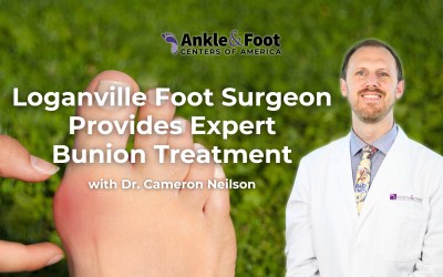 Loganville Foot Surgeon Provides Expert Bunion Treatment