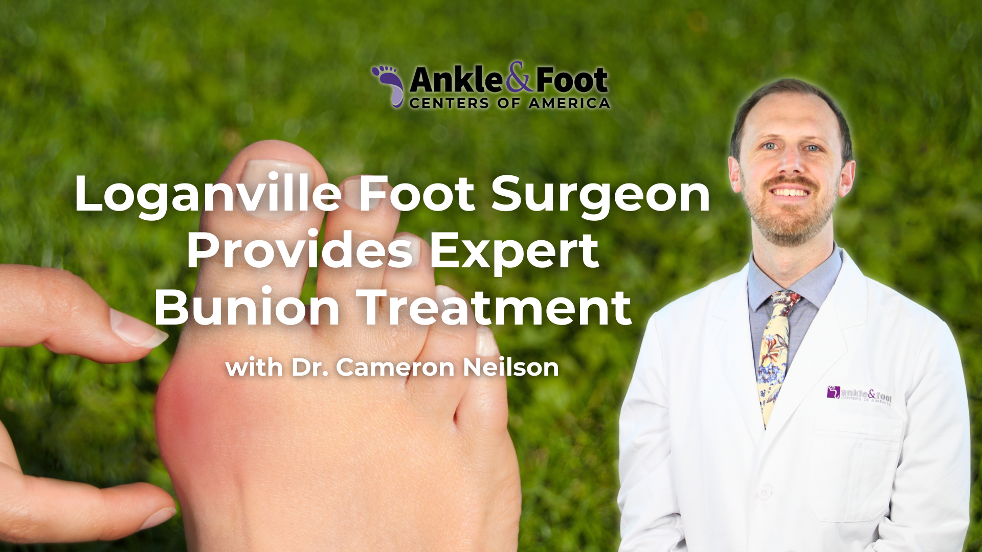 Bunion Treatment Loganville, GA