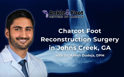 Charcot Foot Reconstruction Surgery in Johns Creek, GA