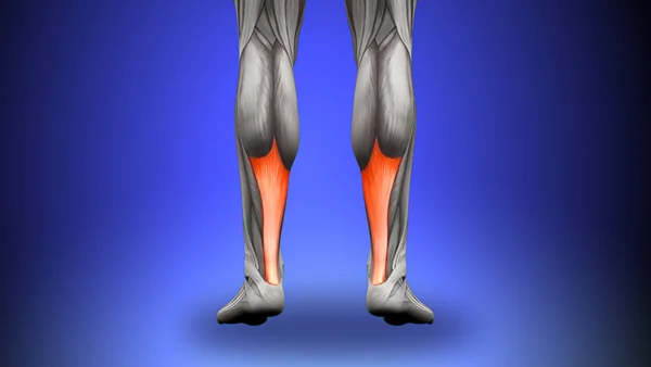 Achilles Tendonitis