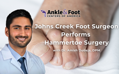 Johns Creek Foot Surgeon Performs Hammertoe Surgery