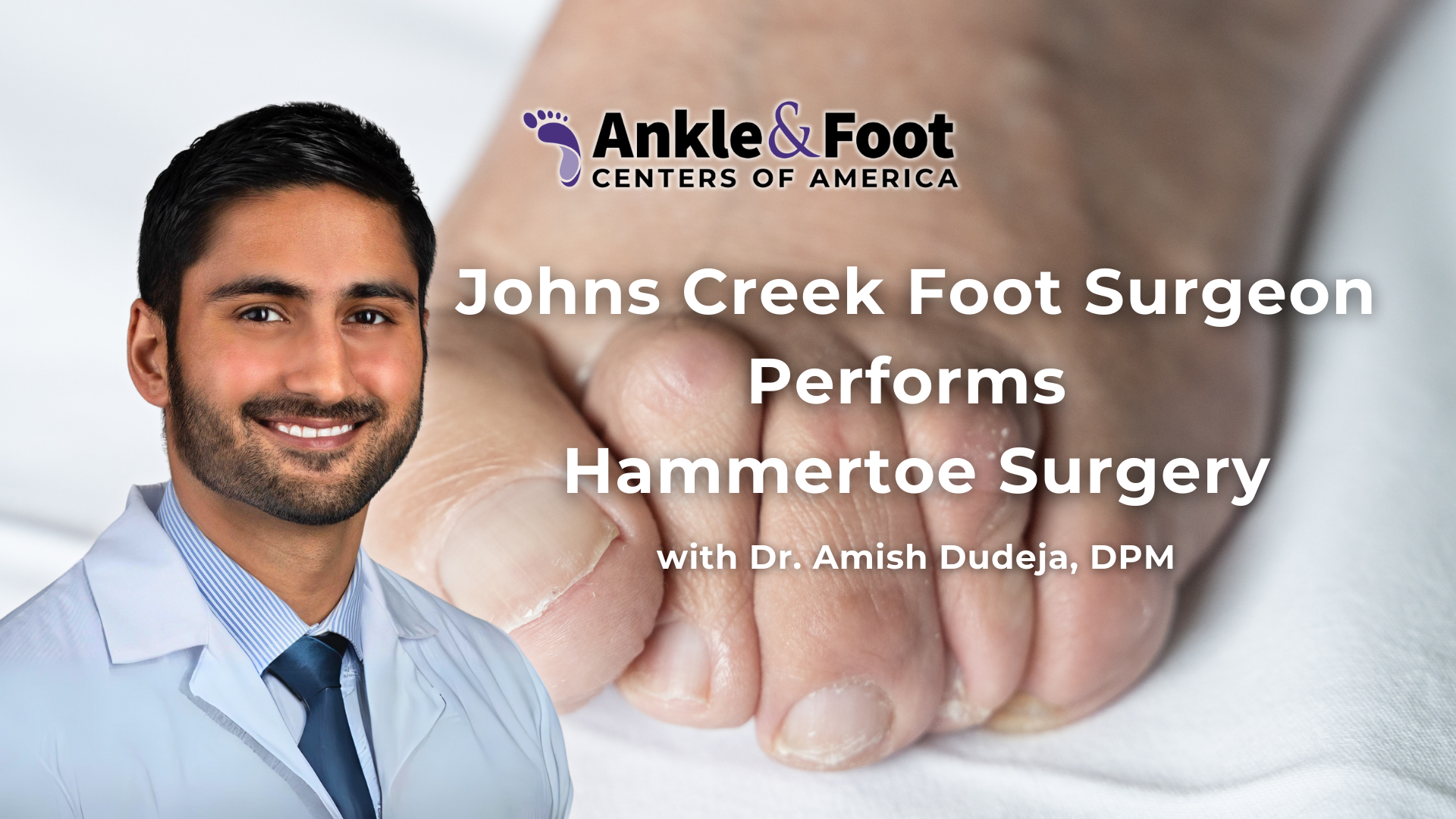 Hammertoe Surgery Johns Creek