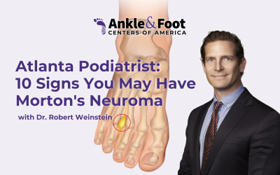 Atlanta Podiatrist: 10 Signs You May Have Morton’s Neuroma