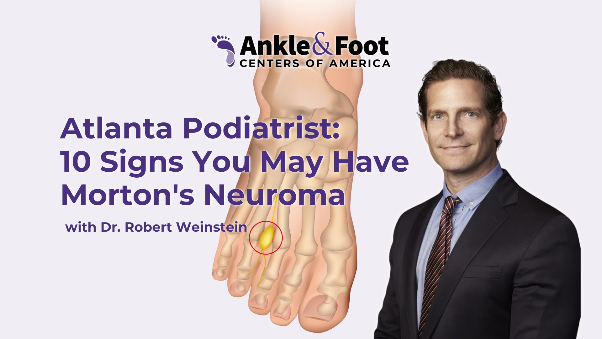 10 Signs You May Have Morton's Neuroma