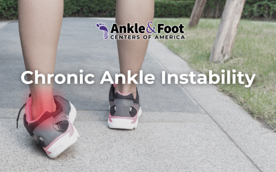 Chronic Ankle Instability: Symptoms, Causes, and Treatment Options