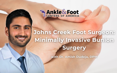 Johns Creek Foot Surgeon: Minimally Invasive Bunion Surgery